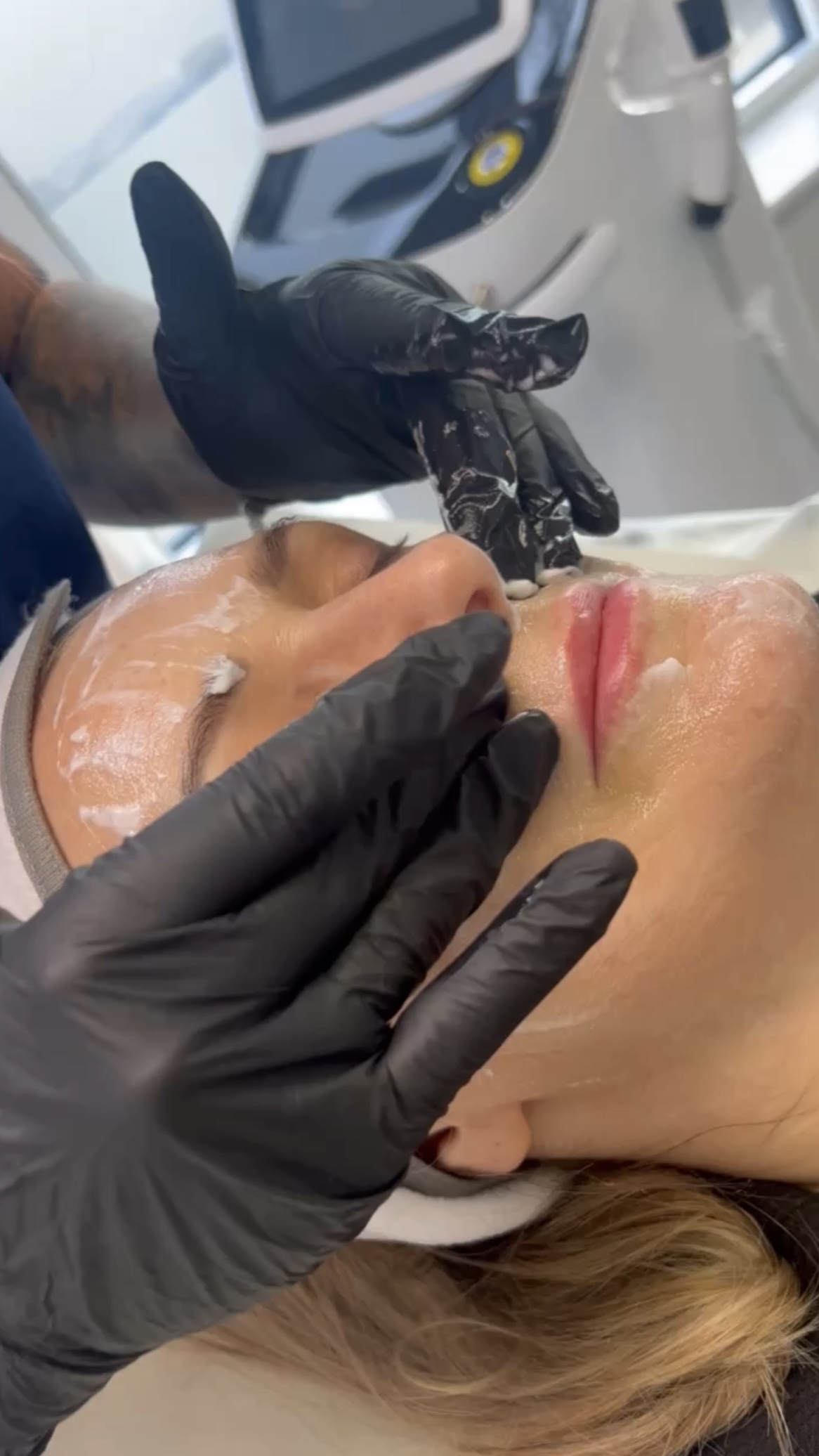 facial