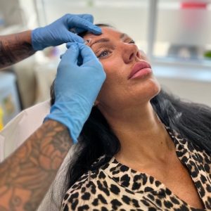 anti-wrinkle injection, masseter, frown line, crows feet